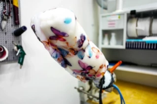 ZIM-Projekt SkolioShirt